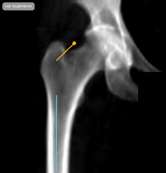 разметка снимка