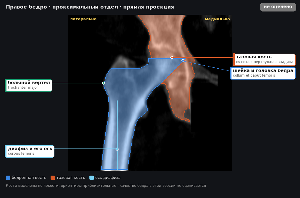 правое бедро