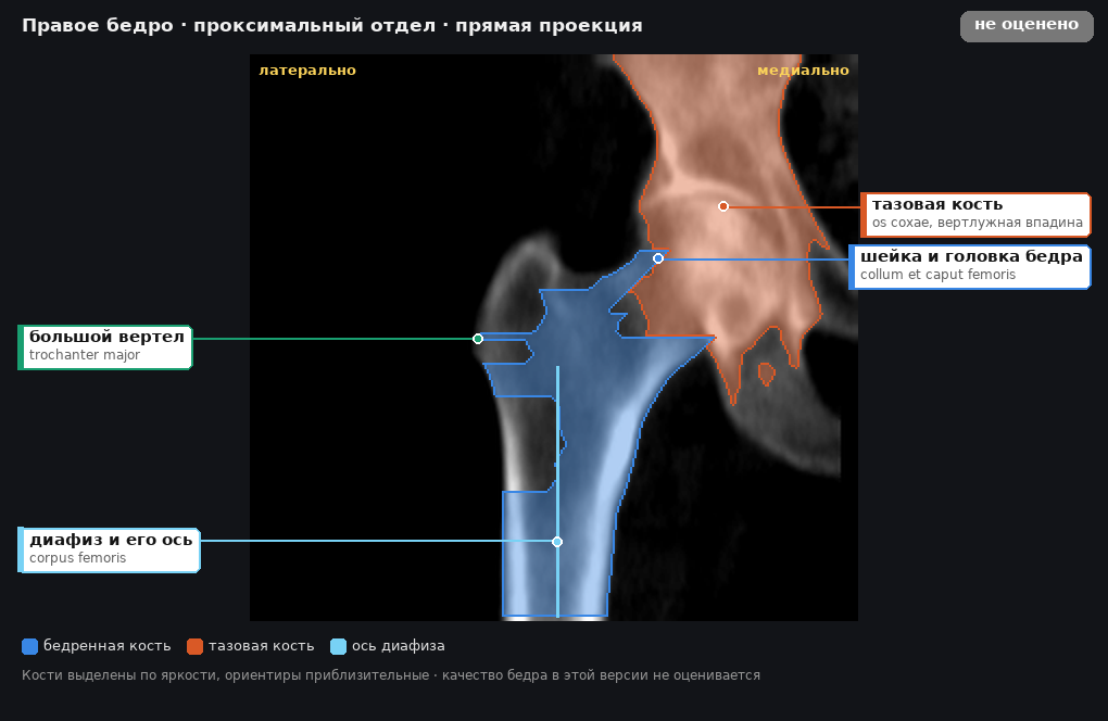 правое бедро