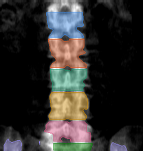 разметка снимка
