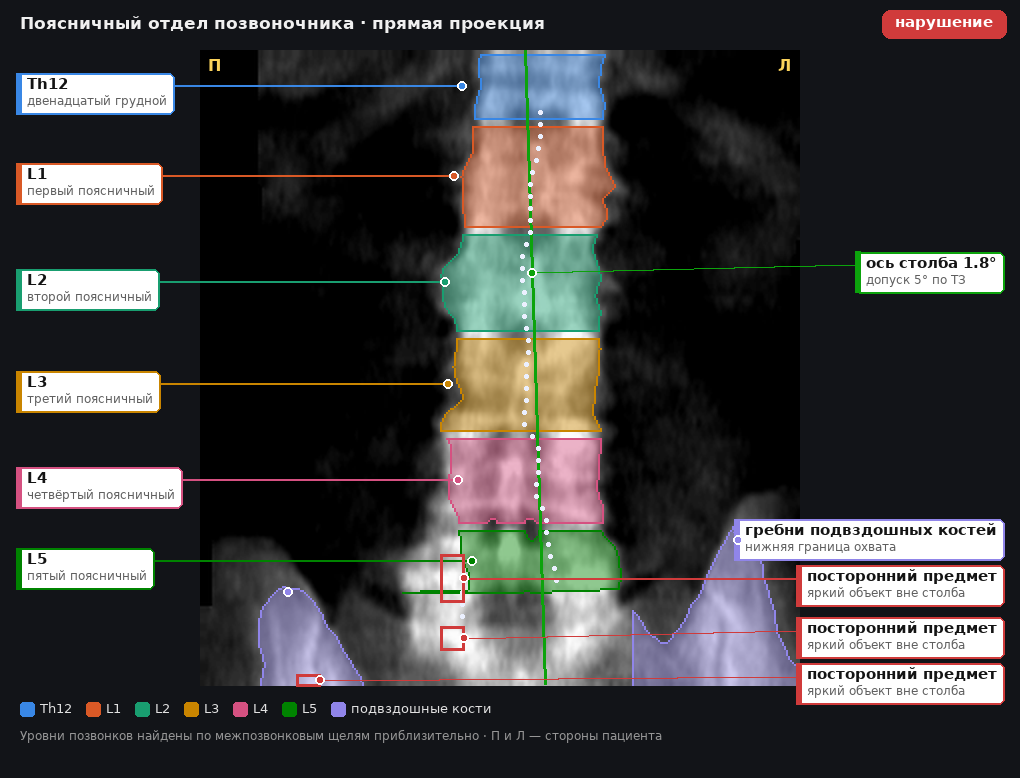 разметка снимка в стиле атласа