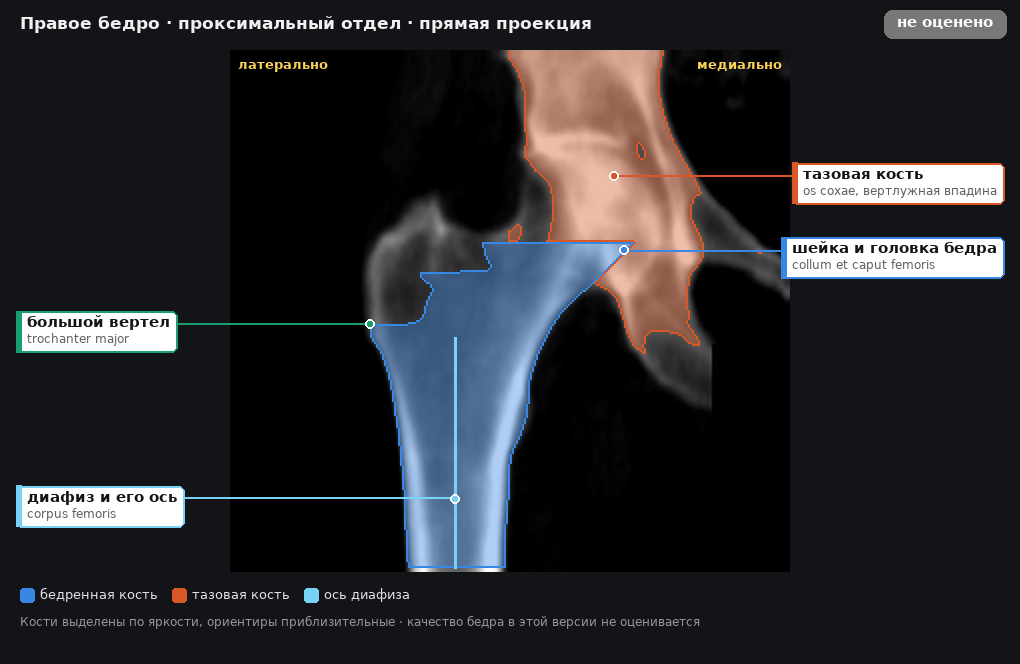 разметка снимка в стиле атласа