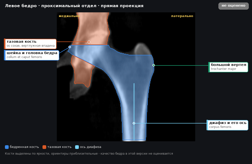 левое бедро