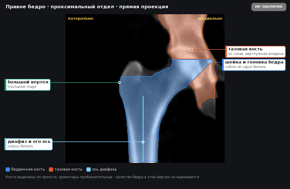 разметка снимка в стиле атласа