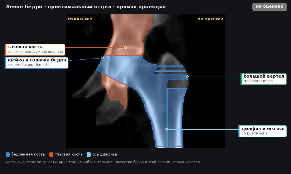 левое бедро