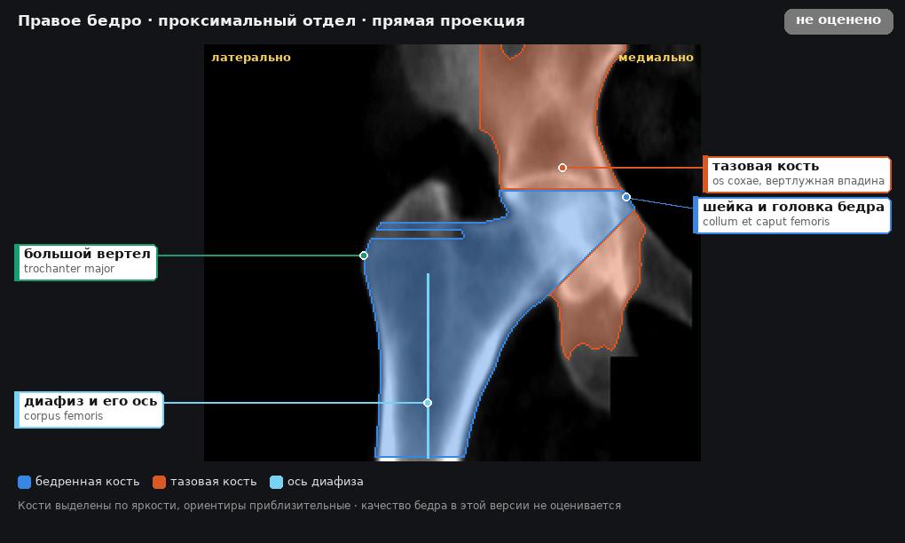 правое бедро