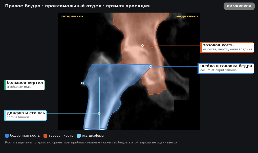 правое бедро