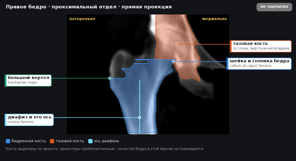 атлас: правое бедро