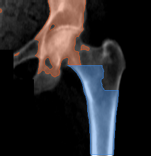 разметка снимка