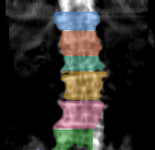 разметка снимка