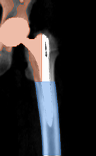разметка снимка