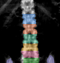 разметка снимка