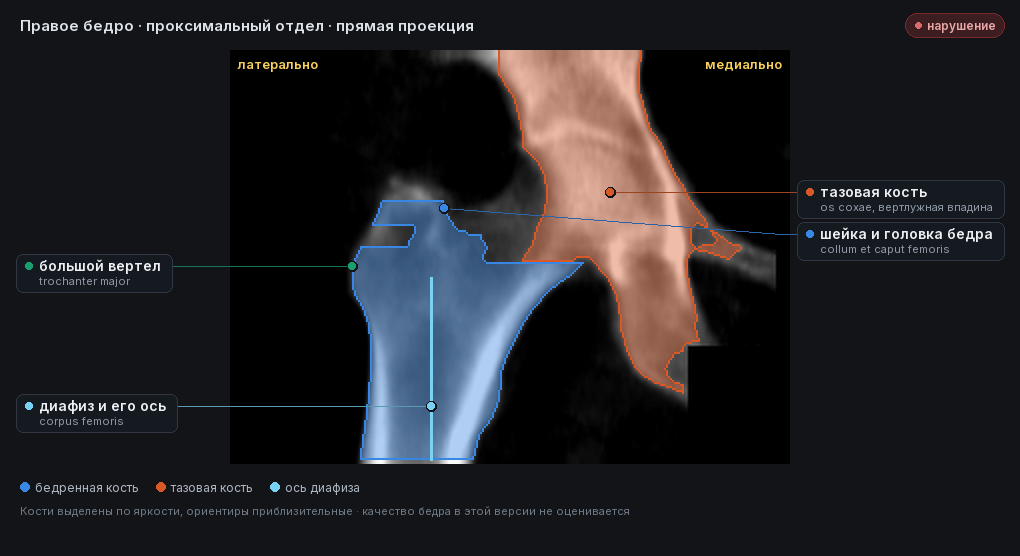 атлас: правое бедро