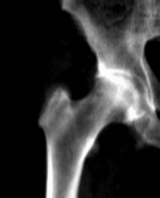 исходный снимок
